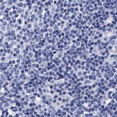 Immunohistochemistry-Paraffin: Arylsulfatase G/ARSG Antibody [NBP1-82947]