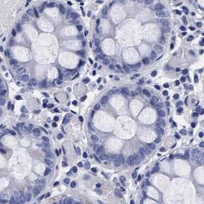 Immunohistochemistry-Paraffin: Arylsulfatase G/ARSG Antibody [NBP1-82948]