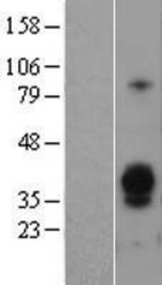 Western Blot: ASGPR1 Overexpression Lysate [NBL1-07762]