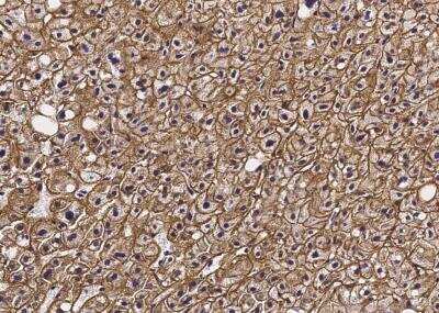 Immunohistochemistry-Paraffin: Asialoglycoprotein Receptor 2 Antibody (002) [NBP3-06211]