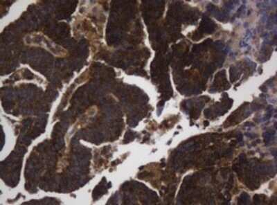 Immunohistochemistry: Asialoglycoprotein Receptor 2 Antibody (OTI2A12) [NBP2-45505]