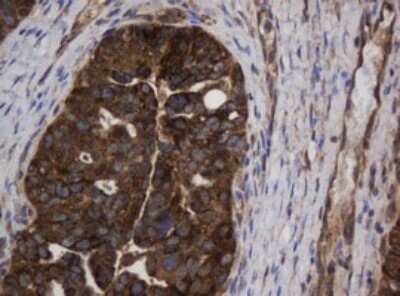 Immunohistochemistry: Asialoglycoprotein Receptor 2 Antibody (OTI2A12) [NBP2-45505]