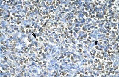 Immunohistochemistry: Asialoglycoprotein Receptor 2 Antibody [NBP1-54888]