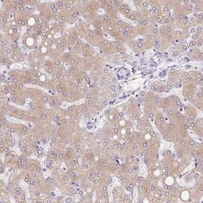 Immunohistochemistry-Paraffin: Asialoglycoprotein Receptor 2 Antibody [NBP1-85578]