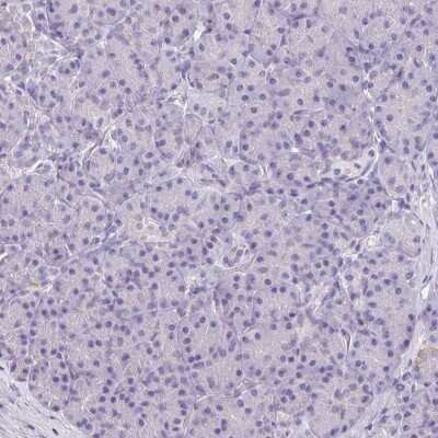 Immunohistochemistry-Paraffin: Asialoglycoprotein Receptor 2 Antibody [NBP1-85578]