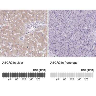 Immunohistochemistry-Paraffin: Asialoglycoprotein Receptor 2 Antibody [NBP1-85578]