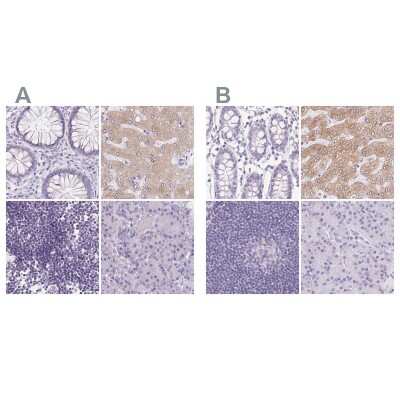 Immunohistochemistry-Paraffin: Asialoglycoprotein Receptor 2 Antibody [NBP1-85578]