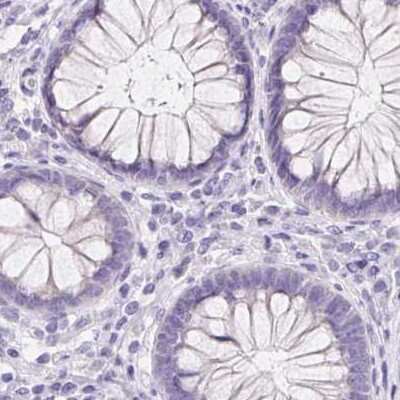 Immunohistochemistry-Paraffin: Asialoglycoprotein Receptor 2 Antibody [NBP1-85578]