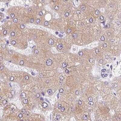 Immunohistochemistry-Paraffin: Asialoglycoprotein Receptor 2 Antibody [NBP1-85578]