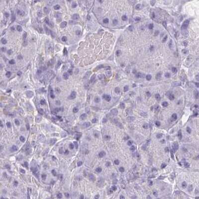 Immunohistochemistry-Paraffin: Asialoglycoprotein Receptor 2 Antibody [NBP1-85578]