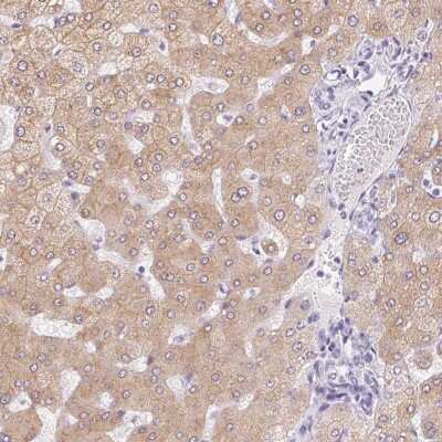 Immunohistochemistry-Paraffin: Asialoglycoprotein Receptor 2 Antibody [NBP1-85579]