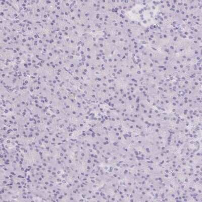 Immunohistochemistry-Paraffin: Asialoglycoprotein Receptor 2 Antibody [NBP1-85579]