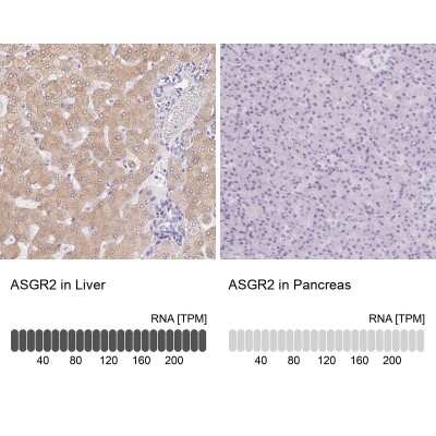 Immunohistochemistry-Paraffin: Asialoglycoprotein Receptor 2 Antibody [NBP1-85579]