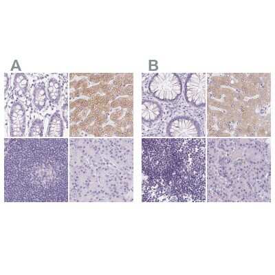 Immunohistochemistry-Paraffin: Asialoglycoprotein Receptor 2 Antibody [NBP1-85579]