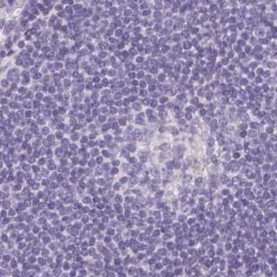 Immunohistochemistry-Paraffin: Asialoglycoprotein Receptor 2 Antibody [NBP1-85579]