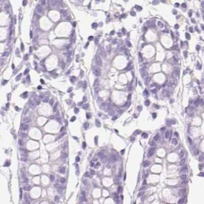 Immunohistochemistry-Paraffin: Asialoglycoprotein Receptor 2 Antibody [NBP1-85579]