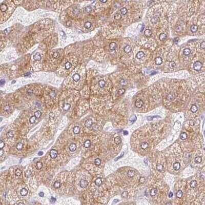 Immunohistochemistry-Paraffin: Asialoglycoprotein Receptor 2 Antibody [NBP1-85579]