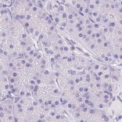 Immunohistochemistry-Paraffin: Asialoglycoprotein Receptor 2 Antibody [NBP1-85579]