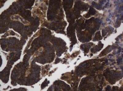Immunohistochemistry: Asialoglycoprotein Receptor 2 Antibody (OTI2A12) - Azide and BSA Free [NBP2-70212]