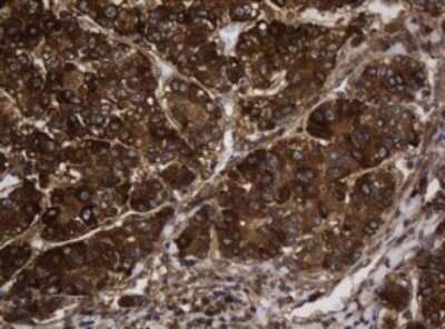 Immunohistochemistry: Asialoglycoprotein Receptor 2 Antibody (OTI2A12) - Azide and BSA Free [NBP2-70212]