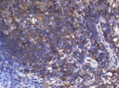 Immunohistochemistry: Asialoglycoprotein Receptor 2 Antibody (OTI2A12) - Azide and BSA Free [NBP2-70212]
