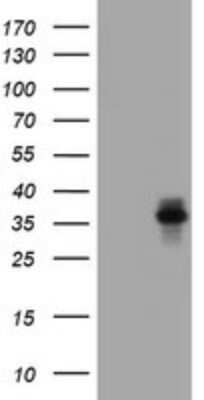 Western Blot: Asialoglycoprotein Receptor 2 Antibody (OTI2A12)Azide and BSA Free [NBP2-70212]