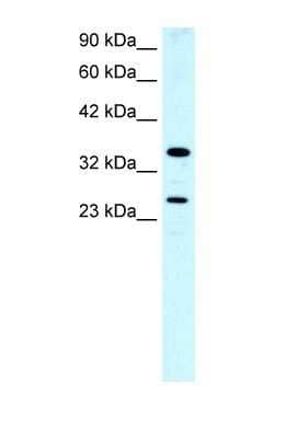 Western Blot: Asialoglycoprotein Receptor 2 Antibody [NBP1-52958]