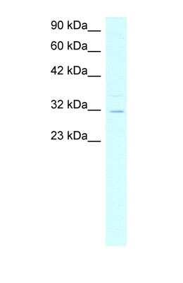 Western Blot: Asialoglycoprotein Receptor 2 Antibody [NBP1-54888]
