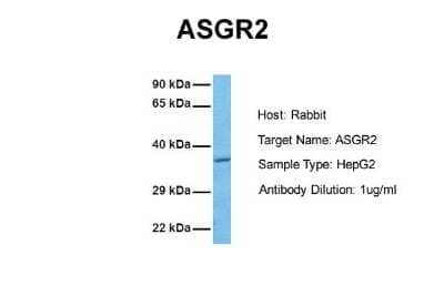 Western Blot: Asialoglycoprotein Receptor 2 Antibody [NBP1-54888]