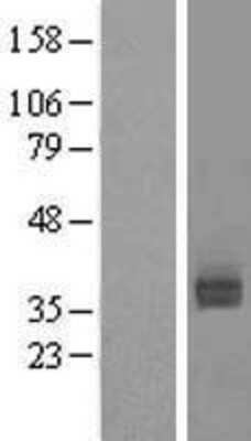 Western Blot: Asialoglycoprotein Receptor 2 Overexpression Lysate [NBL1-07763]