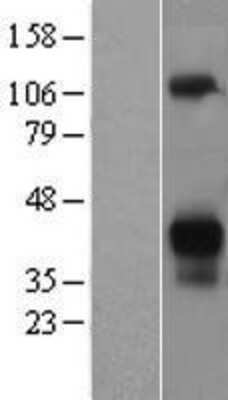 Western Blot: Asialoglycoprotein Receptor 2 Overexpression Lysate [NBL1-07764]