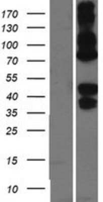 Western Blot: Asialoglycoprotein Receptor 2 Overexpression Lysate [NBP2-05750]