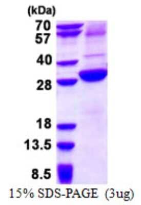 SDS-PAGE: Recombinant Human Asialoglycoprotein Receptor 2 His Protein [NBP2-22697]