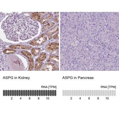 Immunohistochemistry-Paraffin: Asparaginase Antibody [NBP2-49617]