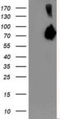 Western Blot: Asparagine synthetase Antibody (OTI1A10) [NBP2-01159]