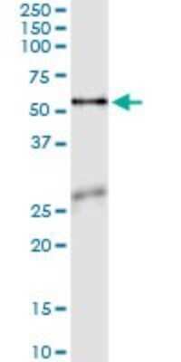 Immunoprecipitation: Asparagine synthetase Antibody (2B3) [H00000440-M02]