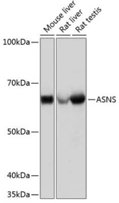 Western Blot: Asparagine synthetase Antibody (7M10Z7) [NBP3-15328]