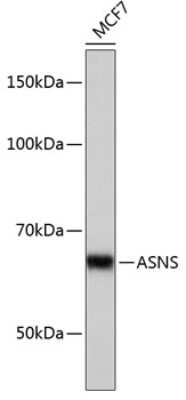 Western Blot: Asparagine synthetase Antibody (7M10Z7) [NBP3-15328]