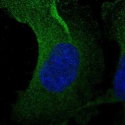 Immunocytochemistry/ Immunofluorescence: Asparagine synthetase Antibody [NBP2-55125]