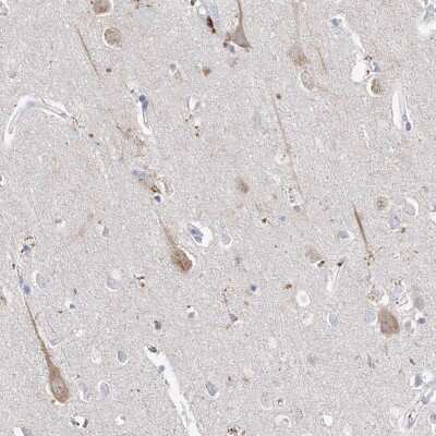 Immunohistochemistry-Paraffin: Asparagine synthetase Antibody [NBP1-87444]