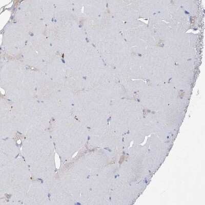 Immunohistochemistry-Paraffin: Asparagine synthetase Antibody [NBP1-87444]