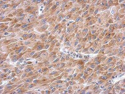 Immunohistochemistry-Paraffin: Asparagine synthetase Antibody [NBP2-14879]