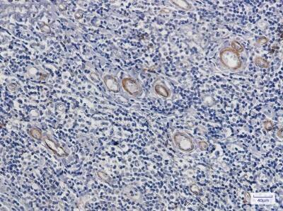 Immunohistochemistry-Paraffin: Asparagine synthetase Antibody (S05-9E5) [NBP3-19507]