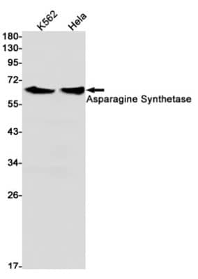 Western Blot: Asparagine synthetase Antibody (S05-9E5) [NBP3-19507]