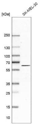 Western Blot: Asparagine synthetase Antibody [NBP1-87444]