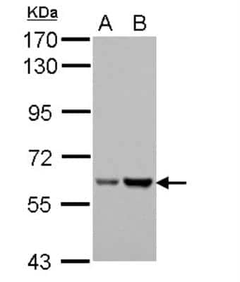 Western Blot: Asparagine synthetase Antibody [NBP2-14879]