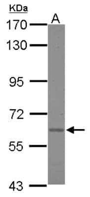 Western Blot: Asparagine synthetase Antibody [NBP2-14880]