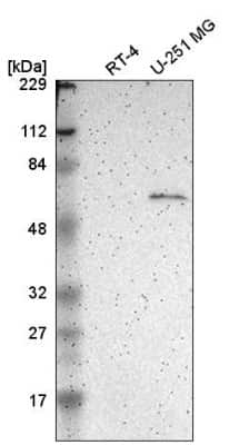 Western Blot: Asparagine synthetase Antibody [NBP2-55125]