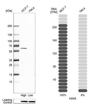Western Blot: Asparagine synthetase Antibody [NBP2-55125]