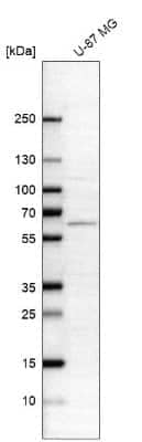 Western Blot: Asparagine synthetase Antibody [NBP2-56407]